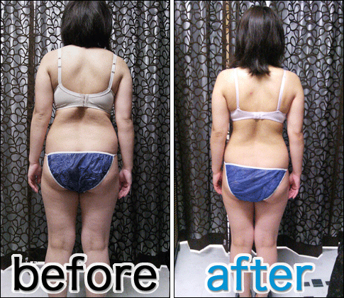 slimming_img002